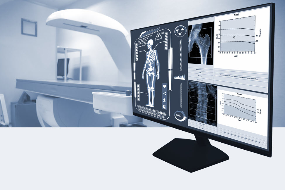 Computer screen displaying bone scan results